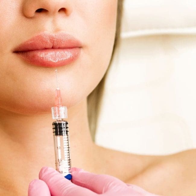 Closeup of syringe next to woman's lips about to inject lip fillers